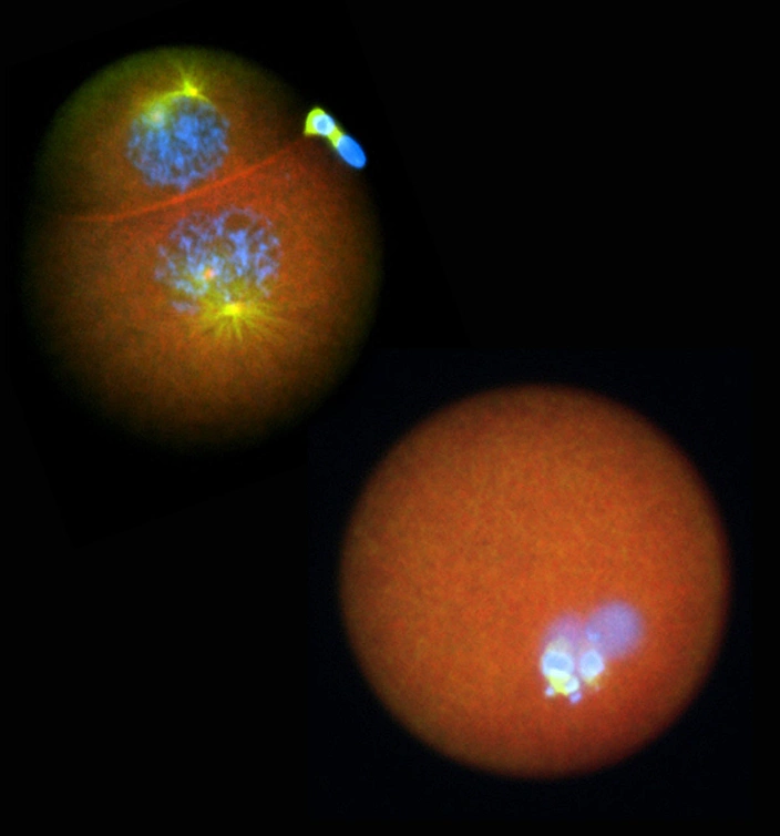 సెంట్రియోల్ గురించి వివరణ | Centriole